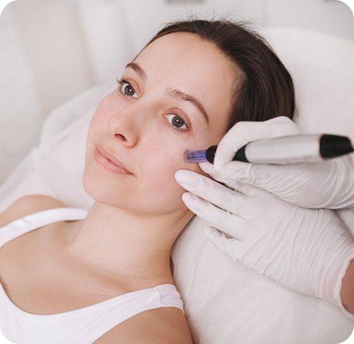 TRATAMIENTOS FACIALES CON DERMAPEN