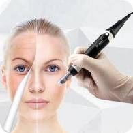 Rejuvenece tu piel con Dermapen